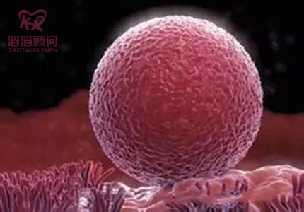 36歲朱女士雙側(cè)輸卵管堵塞 赴俄羅斯試管好孕