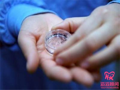 多囊卵巢綜合征患者做試管須知事項(xiàng)