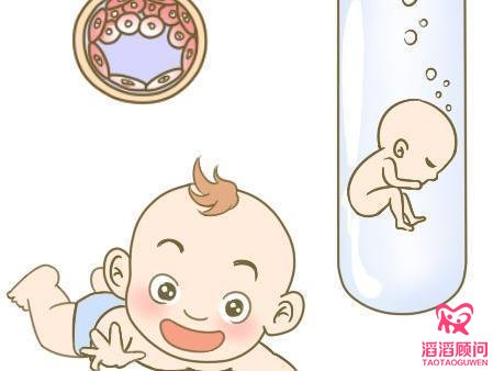 俄羅斯試管嬰兒