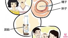 試管嬰兒囊胚移植過程怎么樣？