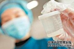 俄羅斯試管嬰兒的取精過程應(yīng)注意哪些問題?