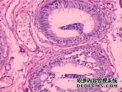 無精子癥能不能做試管嬰兒呢?