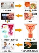 試管嬰兒成功日記紀(jì)錄