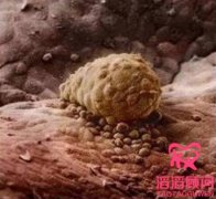 試管嬰兒胚胎著床癥狀有哪些?