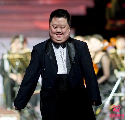 唐氏綜合征唐氏兒