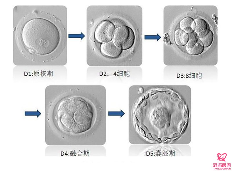 試管嬰兒的胚胎分級