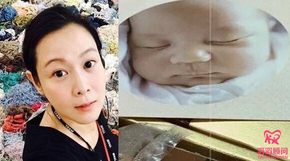 劉若英試管嬰兒