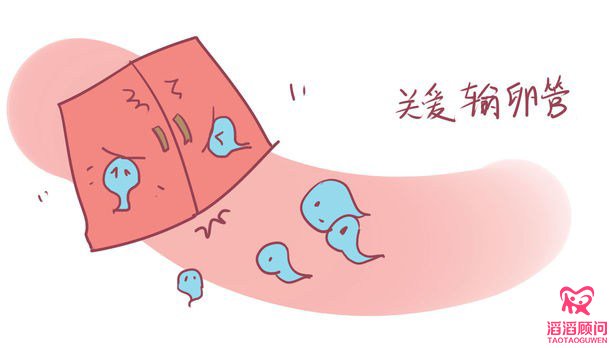 預(yù)防輸卵管積水