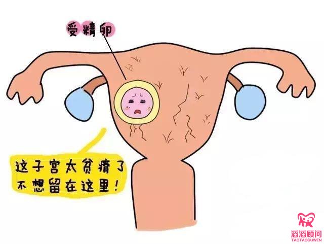 子宮內(nèi)膜