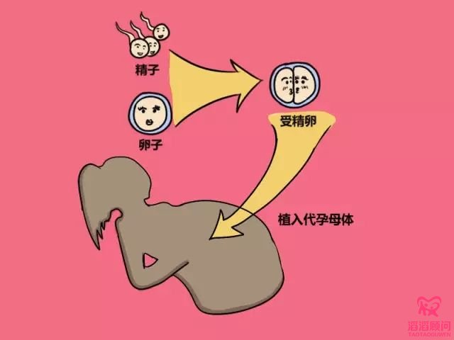 第三方輔助生殖