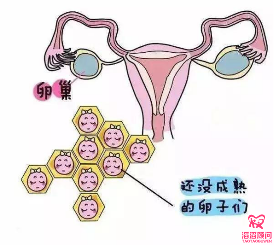 俄羅斯試管嬰兒