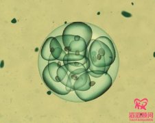 試管嬰兒取卵疼嗎？方法有哪幾種？