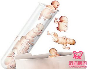 俄羅斯試管嬰兒