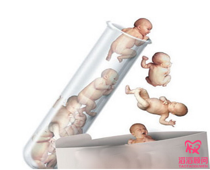 俄羅斯試管嬰兒
