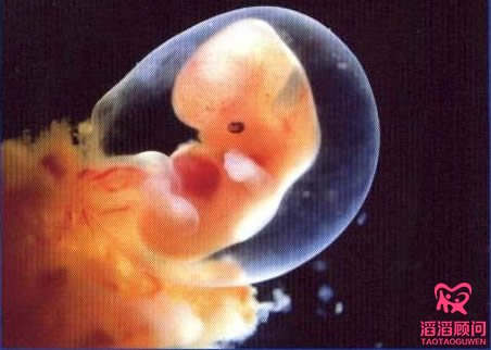 俄羅斯試管嬰兒