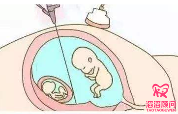 俄羅斯試管嬰兒