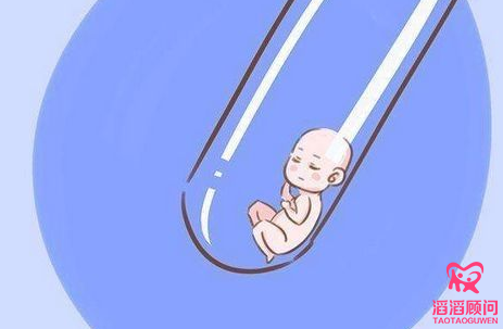 俄羅斯試管嬰兒