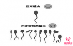 試管嬰兒前男方注意調(diào)理好身體