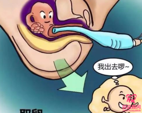 俄羅斯試管嬰兒
