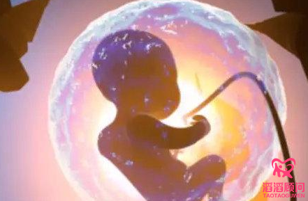 俄羅斯試管嬰兒