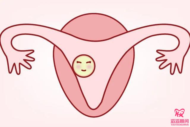 俄羅斯試管嬰兒