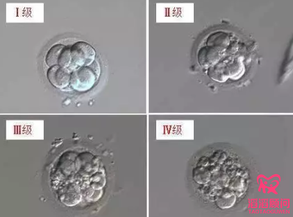 俄羅斯試管嬰兒