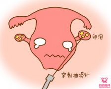 做試管嬰兒對(duì)女人的危害有哪些？